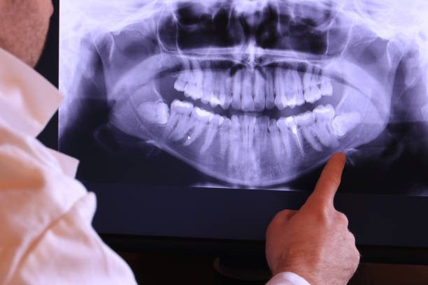 Best Chipped Tooth Repair Near Me  in Quinebaug, CT